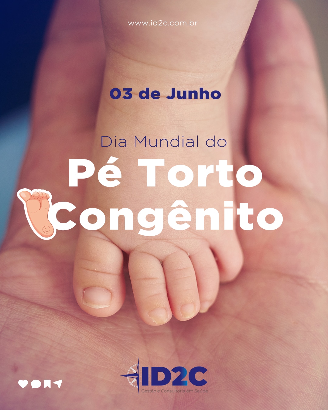 Dia Mundial do Pé Torto Congênito - ID2C